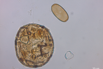 Two microorganisms - Trigonopyxis arcula to the left and Amphitrema flavum to the right